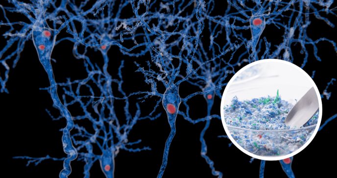 Detectan microplásticos en el cerebro con niveles hasta cinco veces mayores en personas con demencia