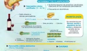 PANCREATITIS CRÓNICA