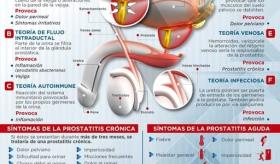 PROSTATITIS