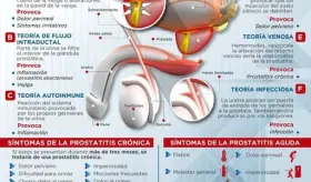 PROSTATITIS