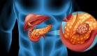 Descubren que el ADN extracromosómico es un factor clave en la agresividad del cáncer de páncreas