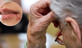 Estudio revela que el virus del herpes podría contribuir al desarrollo de la enfermedad de Alzheimer