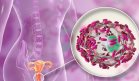 Estudio confirma transmisión sexual de la vaginosis bacteriana y eficacia del tratamiento en parejas