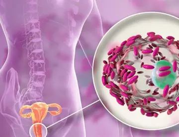 Estudio confirma transmisión sexual de la vaginosis bacteriana y eficacia del tratamiento en parejas