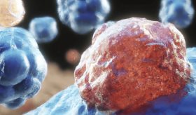 Investigadores revierten células cancerosas de colon y cerebro en saludables mediante regulación genética