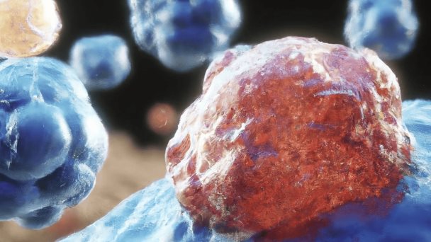 Investigadores revierten células cancerosas de colon y cerebro en saludables mediante regulación genética Investigadores revierten células cancerosas de colon y cerebro en saludables mediante regulación genética