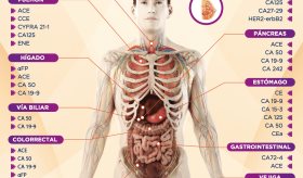 MARCADORES TUMORALES