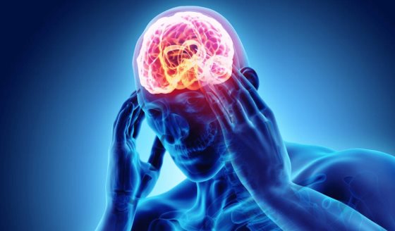 Cefalea por sinusitis, de racimos, tensional y migraña: Los tipos más comunes de dolor de cabeza