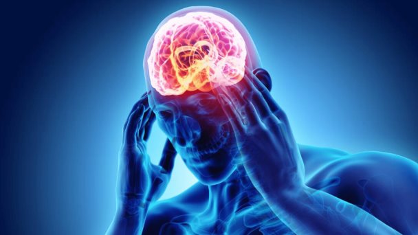 Cefalea por sinusitis, de racimos, tensional y migraña: Los tipos más comunes de dolor de cabeza Cefalea por sinusitis, de racimos, tensional y migraña: Los tipos más comunes de dolor de cabeza