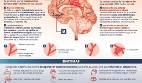 ACCIDENTE CEREBROVASCULAR