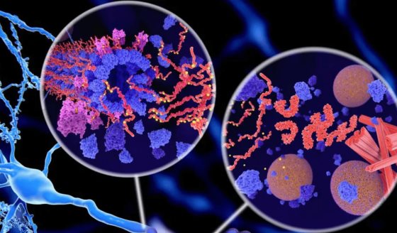 Proteína CD2AP podría frenar la neurodegeneración en la enfermedad de Alzheimer, según estudio
