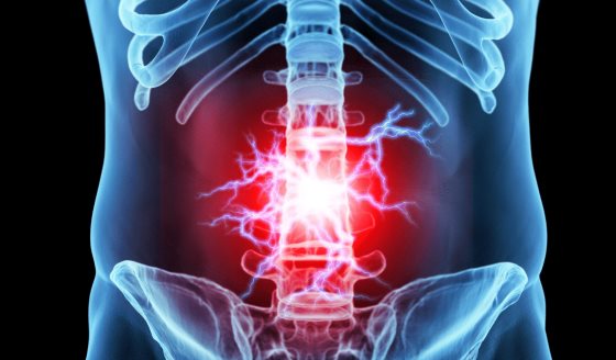 Paracetamol y osteopatía carecen de evidencia sólida para tratar el dolor lumbar, según estudio