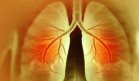 Enfermedad pulmonar intersticial en reumatología: detección, tratamiento y seguimiento