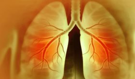 Enfermedad pulmonar intersticial en reumatología: detección, tratamiento y seguimiento