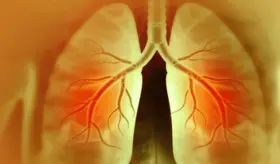 Enfermedad pulmonar intersticial en reumatología: detección, tratamiento y seguimiento