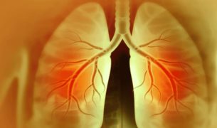 Enfermedad pulmonar intersticial en reumatología: detección, tratamiento y seguimiento