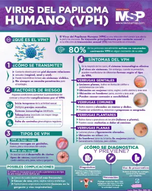 Infografia