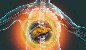 LiverRisk: El avance científico que podría reducir los casos de cirrosis y cáncer de hígado