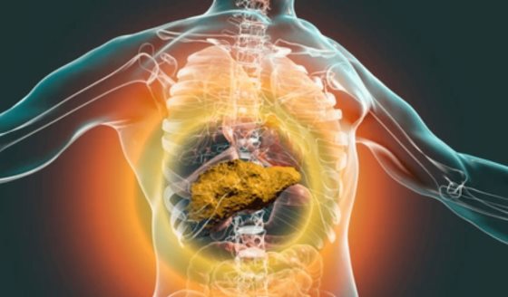 LiverRisk: El avance científico que podría reducir los casos de cirrosis y cáncer de hígado
