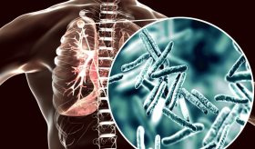 Alerta sobre aumento de casos y muertes por tuberculosis tras la pandemia de COVID-19