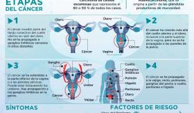 CÁNCER DE CUELLO UTERINO