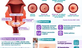 CÁNCER DE CUELLO UTERINO