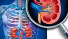 Aumento de la enfermedad renal resalta la conexión crítica entre los riñones y el corazón