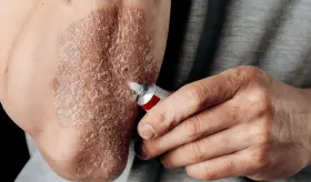 Plataforma digital como herramienta de enfermería en manejo integral de psoriasis y artritis psoriásica