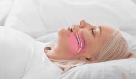 Apnea obstructiva del sueño en mujeres presenta diferencias respecto a los hombres, según estudio