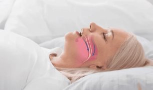 Apnea obstructiva del sueño en mujeres presenta diferencias respecto a los hombres, según estudio
