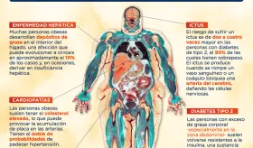 EL PROBLEMA DE LA GRASA