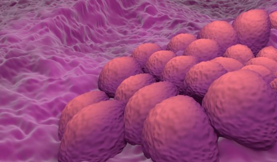 Desarrollan un modelo de IA con 99% de precisión para la detección del cáncer endometrial