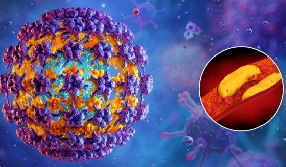 Personas con VPH tienen hasta el doble de riesgo de desarrollar una enfermedad coronaria: estudio