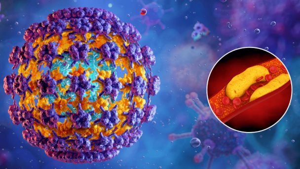 Personas con VPH tienen hasta el doble de riesgo de desarrollar una enfermedad coronaria: estudio Personas con VPH tienen hasta el doble de riesgo de desarrollar una enfermedad coronaria: estudio