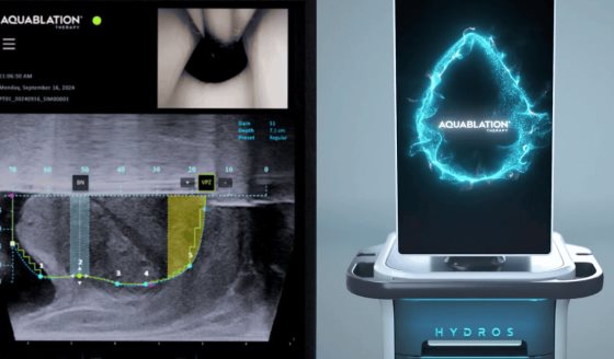Hospital Auxilio Mutuo: Primer centro en PR en ofrecer cirugía de próstata con Aquablation
