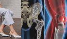 ¿Por qué no es buena idea usar tacones después de la menopausia? Evite fracturas, dolor y lesiones