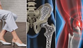 ¿Por qué no es buena idea usar tacones después de la menopausia? Evite fracturas, dolor y lesiones