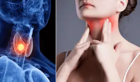 ¿Fatiga, aumento de peso, y alteraciones menstruales? Así podría impactar la tiroides a las mujeres