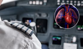 Dilatación aórtica, valvulopatías y arritmias ocultas: riesgos cardiovasculares que amenazan a pilotos 