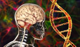 Demencia vascular: Esta es la segunda causa más común de deterioro cognitivo tras el alzhéimer