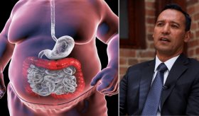 "Muere más gente de gorda que de desnutrición": la polémica frase del ministro de Defensa en el Congreso