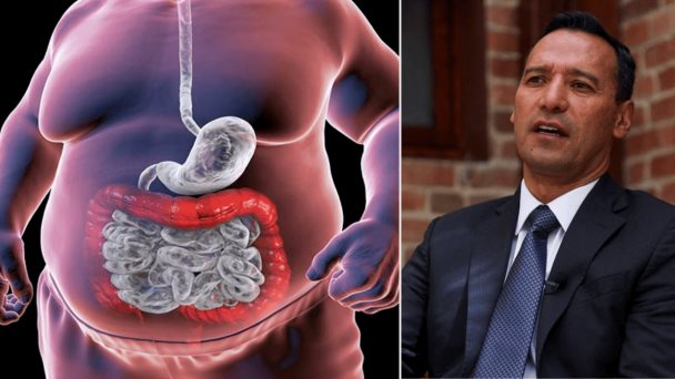 "Muere más gente de gorda que de desnutrición": la polémica frase del ministro de Defensa en el Congreso "Muere más gente de gorda que de desnutrición": la polémica frase del ministro de Defensa en el Congreso