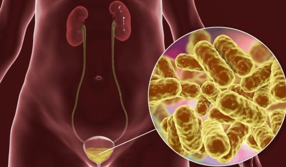 Desarrollan vacuna sublingual que reduce infecciones urinarias recurrentes y el uso de antibióticos
