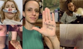 Enfermeras alertan sobre agresiones violentas por parte de los pacientes, una realidad poco visibilizada