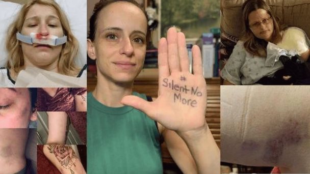 Enfermeras alertan sobre agresiones violentas por parte de los pacientes, una realidad poco visibilizada Enfermeras alertan sobre agresiones violentas por parte de los pacientes, una realidad poco visibilizada