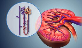 Fármaco experimental podría frenar la insuficiencia renal al bloquear el colágeno tipo 5