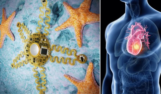 Crean un parche inteligente inspirado en estrellas de mar para detectar enfermedades del corazón