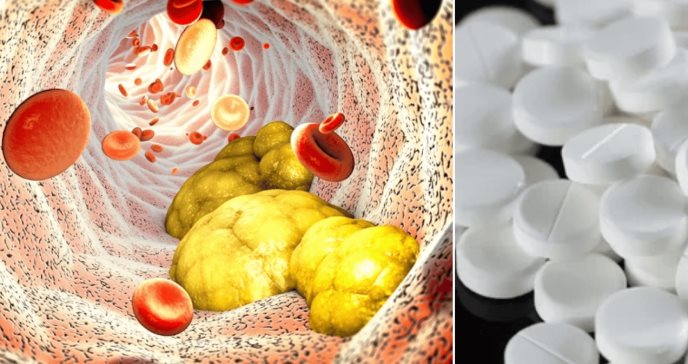 Terapia combinada con estatinas y ezetimiba reduce 30% riesgo post-infarto, según estudio 