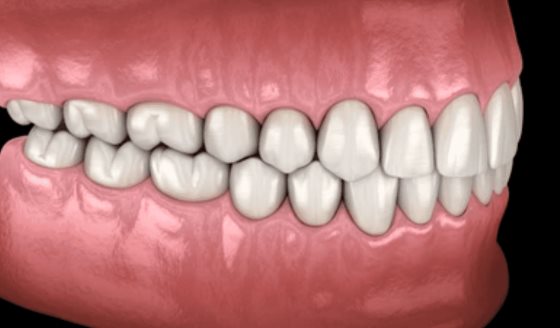 Crean dientes humanos en laboratorio con células del propio paciente: Más fuertes y sin riesgo de rechazo