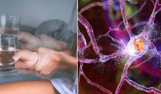 El ritmo de vida acelerado y los malos hábitos podrían aumentar el riesgo de desarrollar párkinson